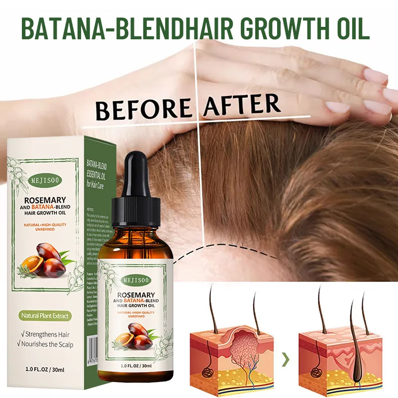 Private Label Hair Care 100% Natural Herbal Organic Wholesale Loss Treatment Rosemary Batana Oil Growth Serum for Hair