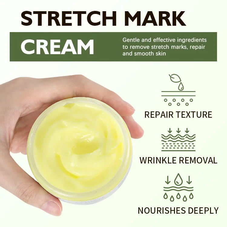 Private Label Organic Scar repair cream desalt hyperplasia pregnancy creamAcne Stretch Marks Scar Removal Cream Tummy Tuck Cream