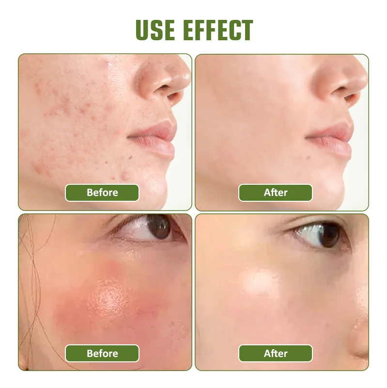 Smoothing Gel Aloe Vera Face Cream Moisturizing Repairing Anti-aging Aloe Vera Gel