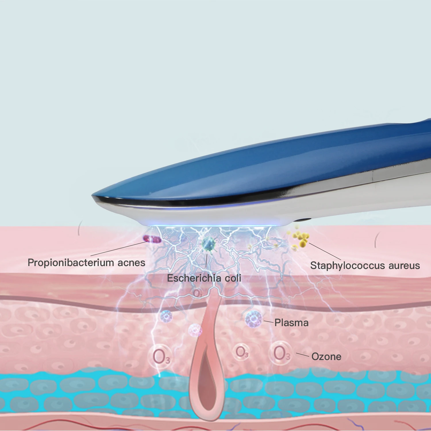 Newest Skin Rejuvenationn Plasma Beauty Device Acne Anti-inflammatory Professional Facial Plasma Beauty Device for Personal Care