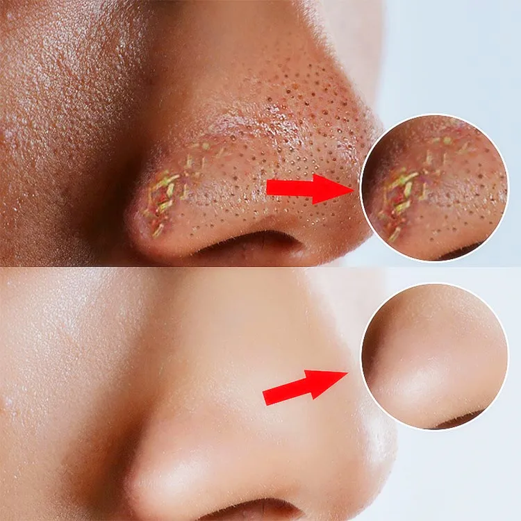 Private Label Blackhead Remover Pore Minimizing Face Natural Activated Mens Charcoal Face Wash