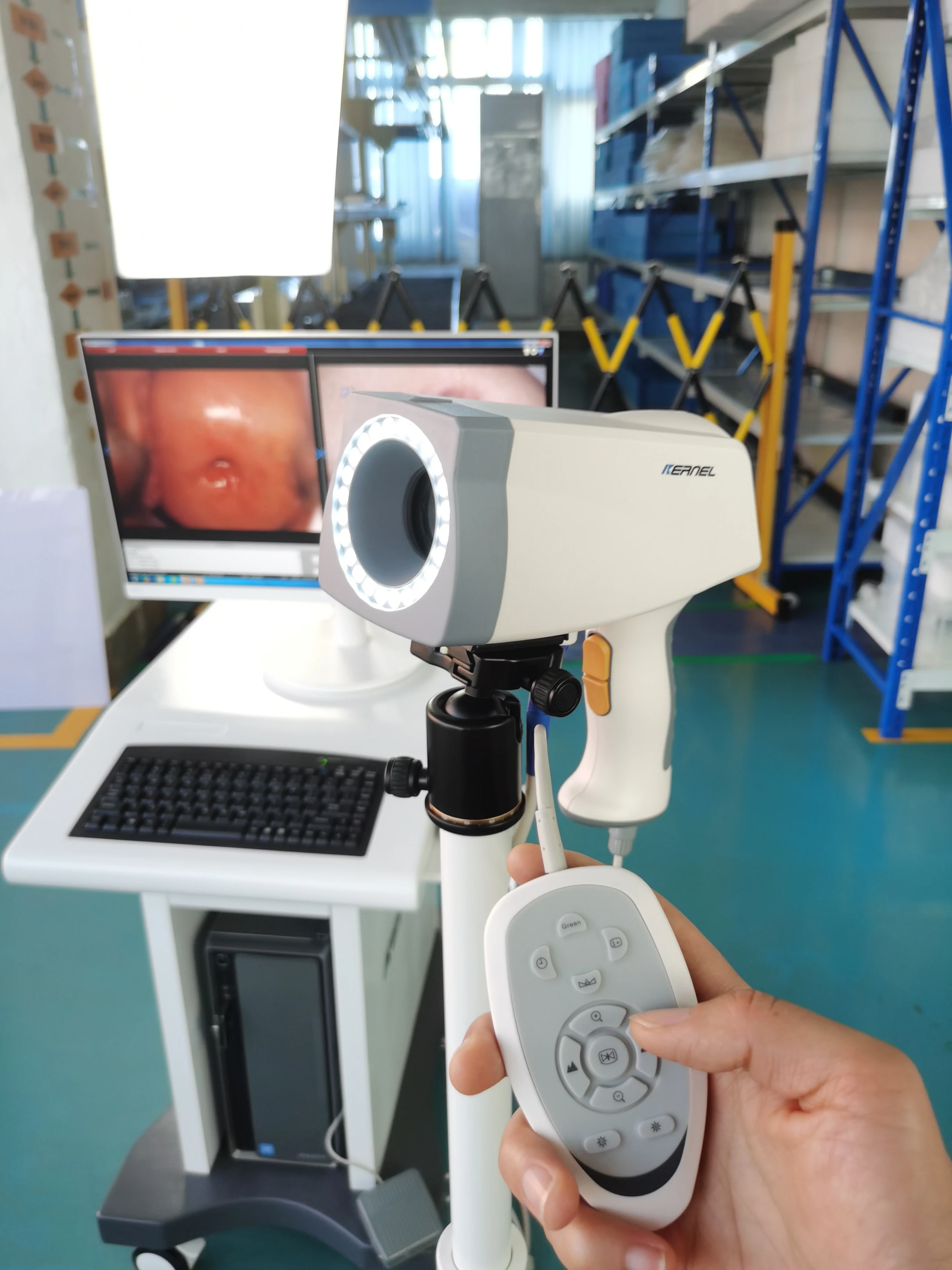 Kernel KN 2200 Full digital video colposcope machine Portable Gynecology Colposcopy System