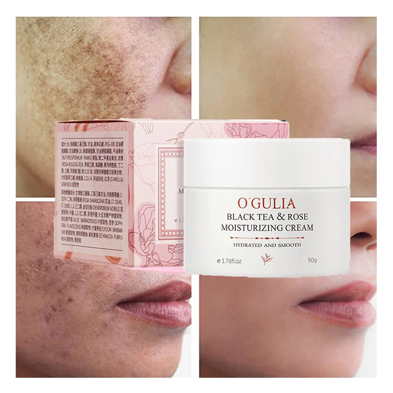Black Tea Rose Moisturizing Cream Whitening Remove Dark Spots Fade Acne Scars Melanin Pigmentation Melasma Anti-Aging Cream
