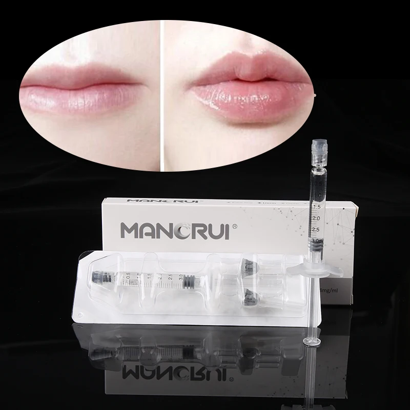 
Best selling 3ml hyaluronic acid dermal filler lip filler inject with needle 