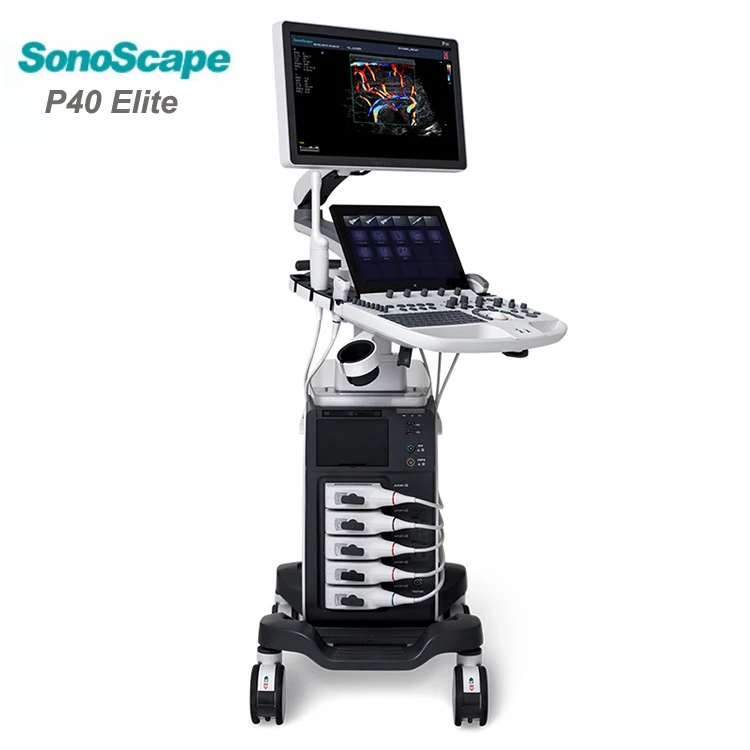 Sonoscape P40 Ultrasound Instruments 4d Full Digital Trolley Color Doppler Ultrasound Machine for Medical