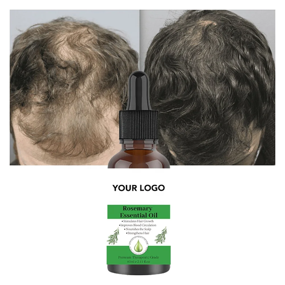 Growth For Hair Rosemary Oil Serum Repairs Luxury Hair Growth Rosemary Mint Hair Serum Oil