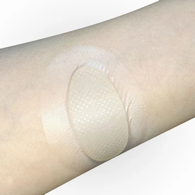 Factory Custom Hydrogel Blister Plaster hydrogel wound dressing