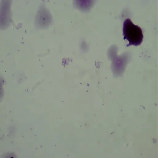 Medical Microbiology Slides Microscope Slides 100pcs Educational Prepared Slides Medical Microbiology Education