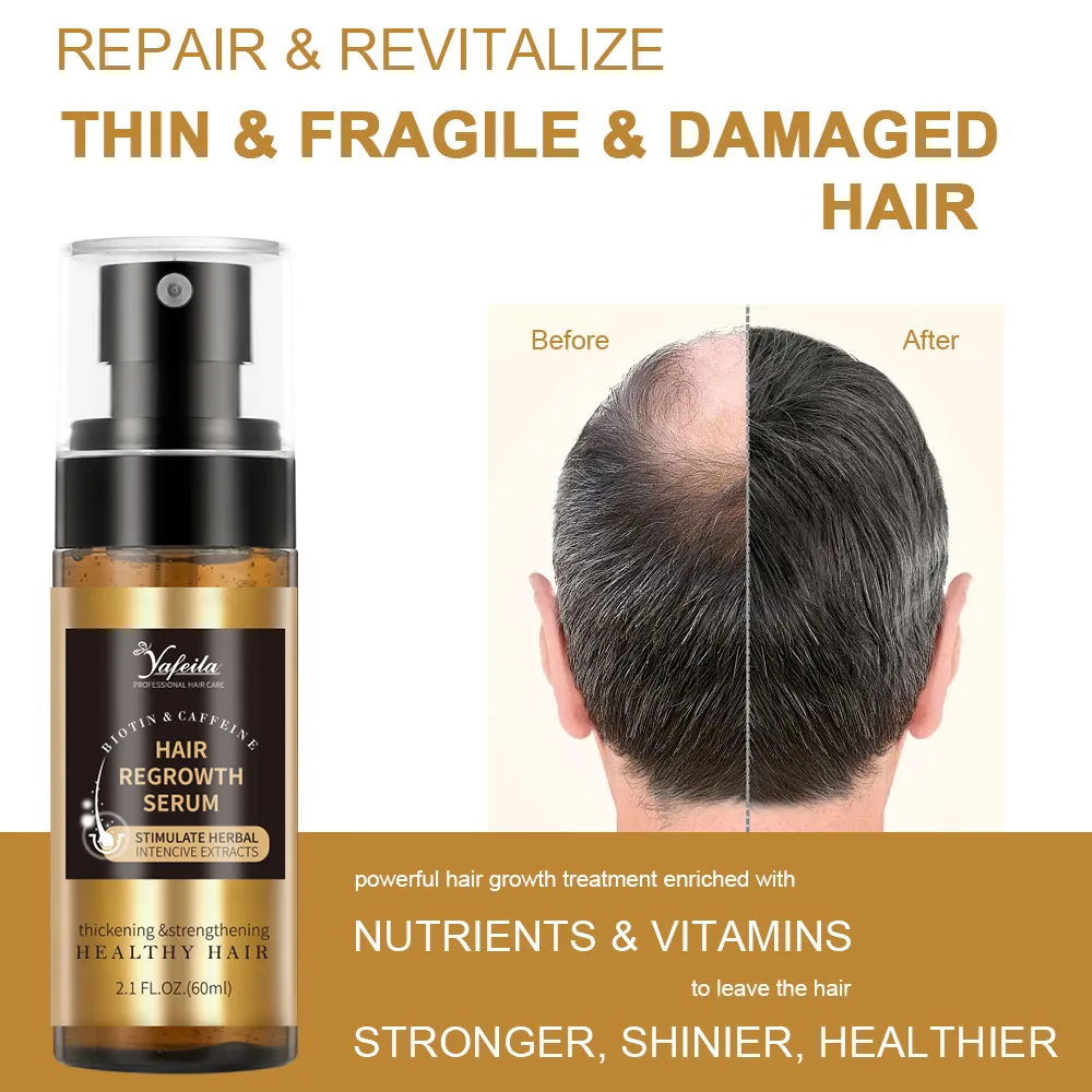 Factory Bulk 60ml Biotin Hair Growth Spray for Men and Women Fast Regrowth Treatment Serum to Stop Hair Loss