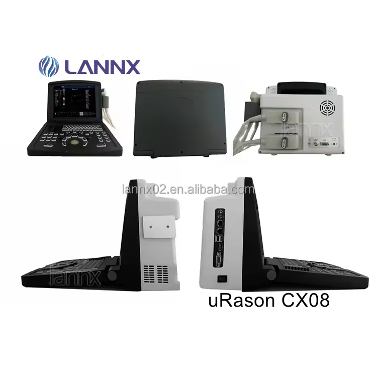 LANNX uRason CX08 Самый дешевый портативный цветной Доплеровский Ультразвуковой 2D 3D Больничная система диагностики USG CW/PW эхокардиографический аппарат
