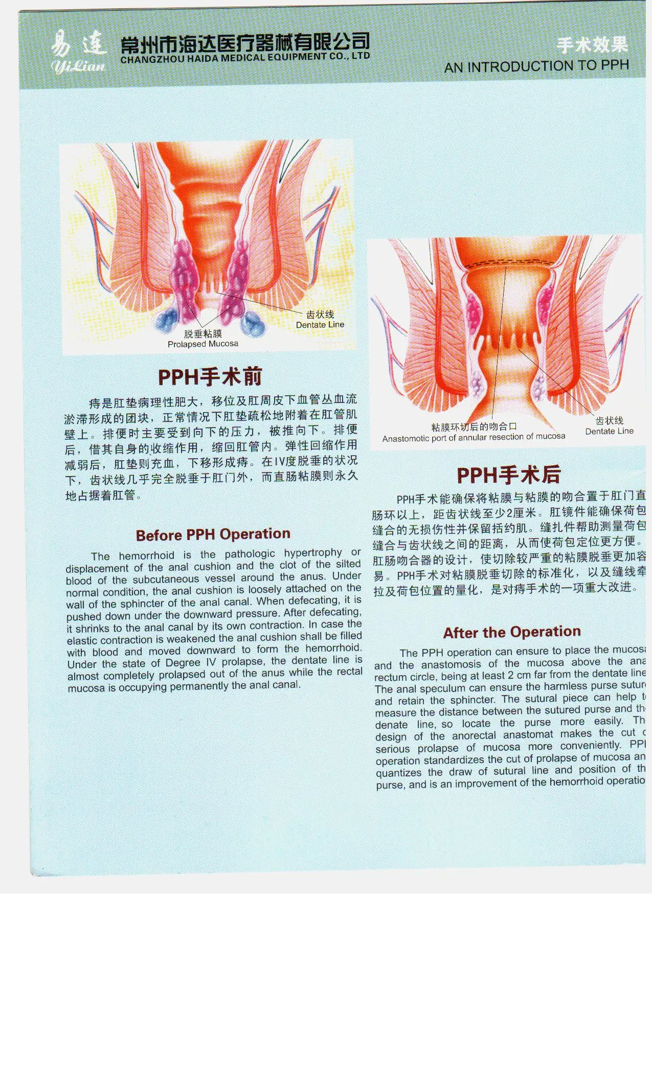 SURGICAL circular hemorrhoid PPH stapler 33MM 34MM 32MM