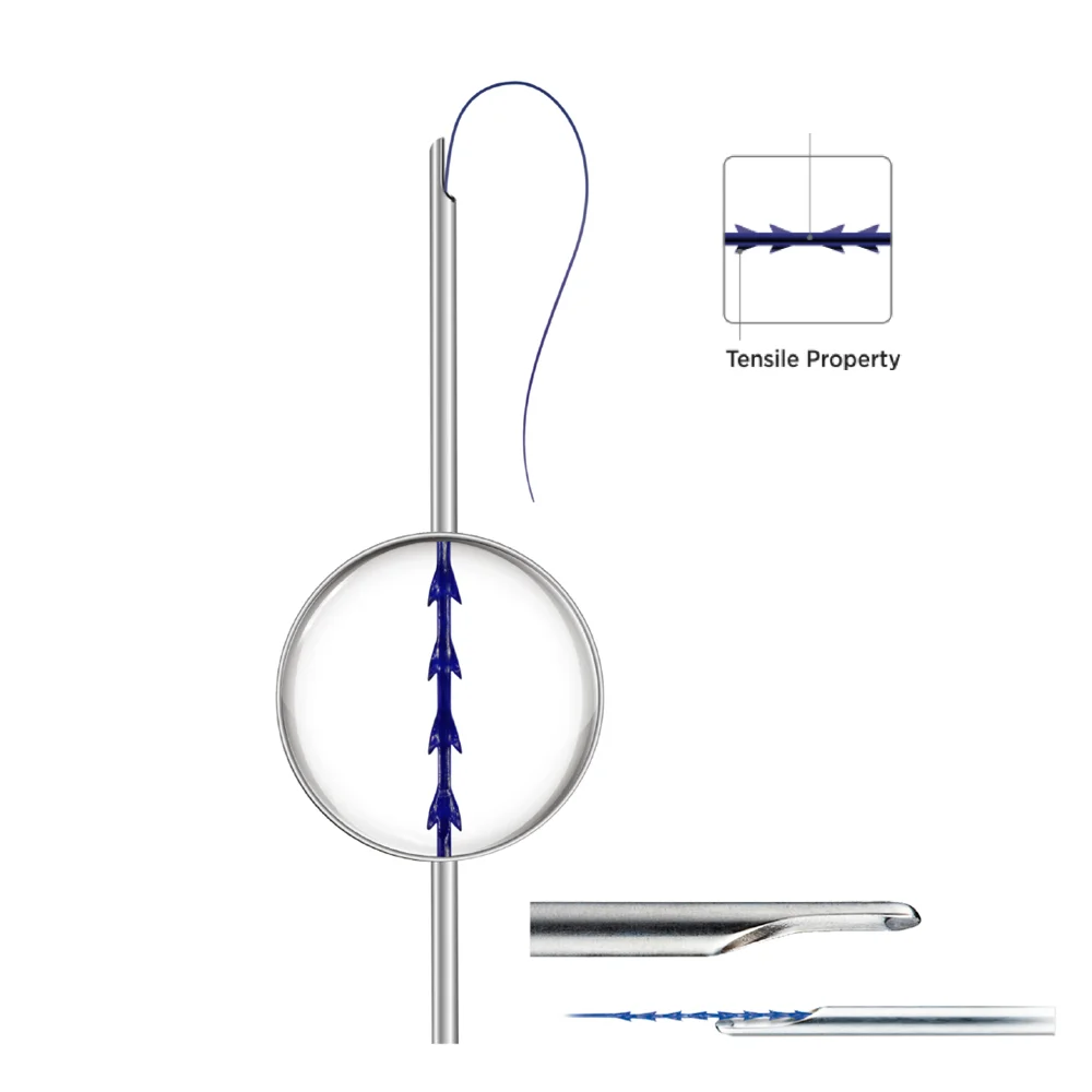 Высокое качество подтяжка лица ПДО для ухода за кожей лица подтяжки кожи литья нить