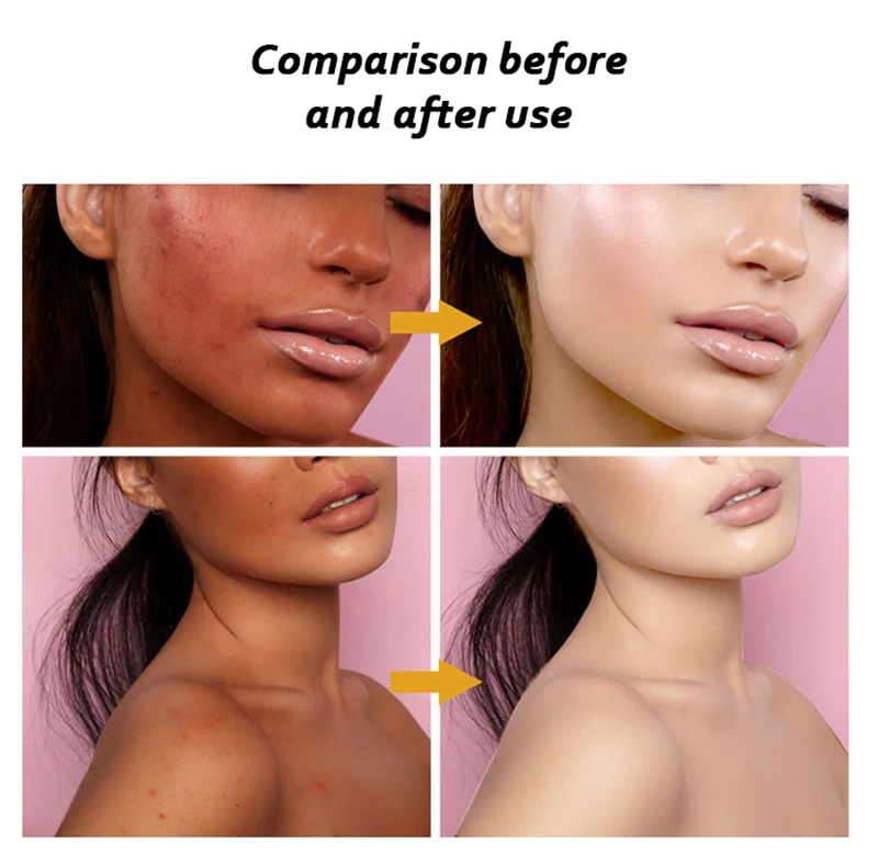 Super Whitening 24K Gold Day and Night Face Beauty Cream Glutathion & Kojic Natural Glowing Skin Best Anti-aging Cream