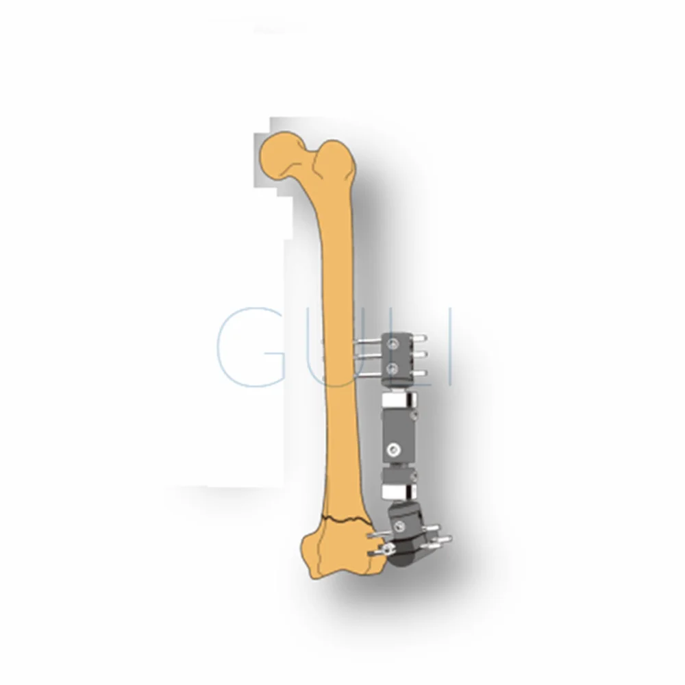 Surgical Fixator Clamp Instrumentsmicro Movement Fixator Long T Clamp