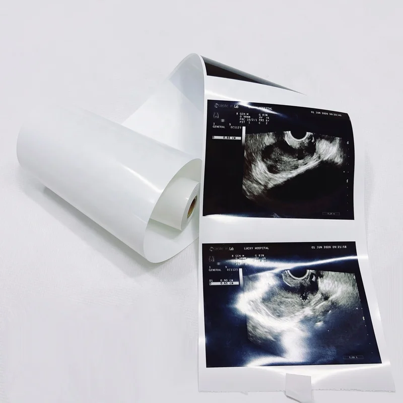 standard 110s ultrasound thermal paper roll