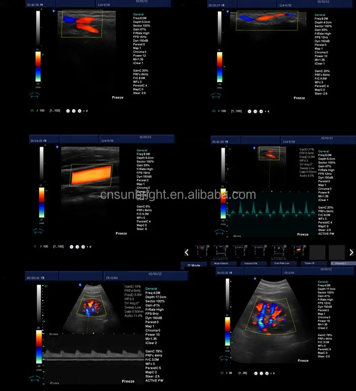 Newest trolley mobile colour doppler ultrasound machine 3D 4D Mobile cardiac echocardiogram