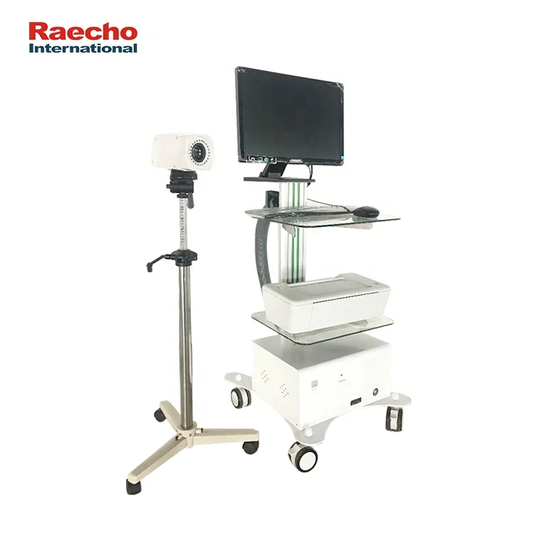 Advanced Technology Dynamic Video Colposcope Price