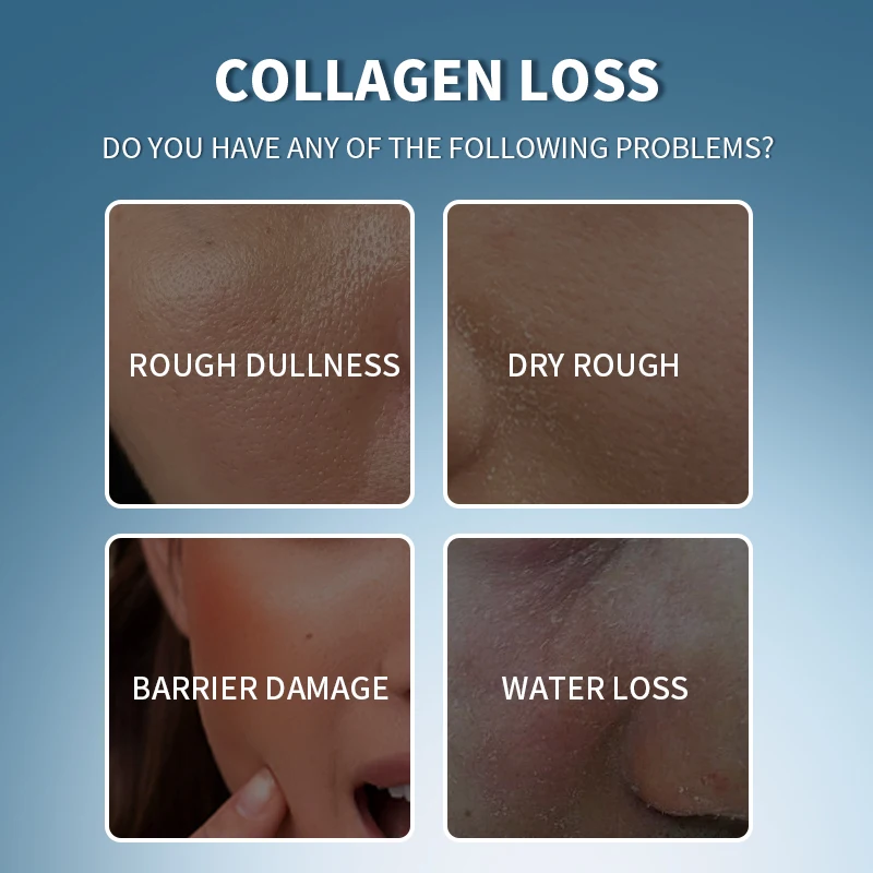 Korean Anti Wrinkle Discoloration Correcting Serum Collagen Protein Mesotherapy Serums Whitening Ampoule Serum OEM Wholesale