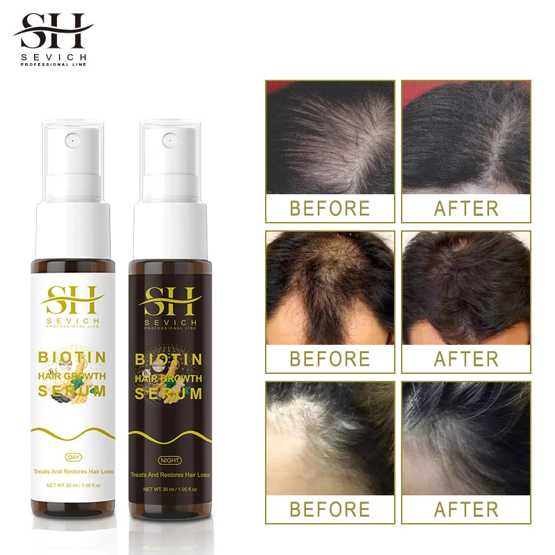 Fast Hair Growth Oil For Black Women Private Label Argan Oil Hair Growth Natural Wild Hair Growth Oil Set