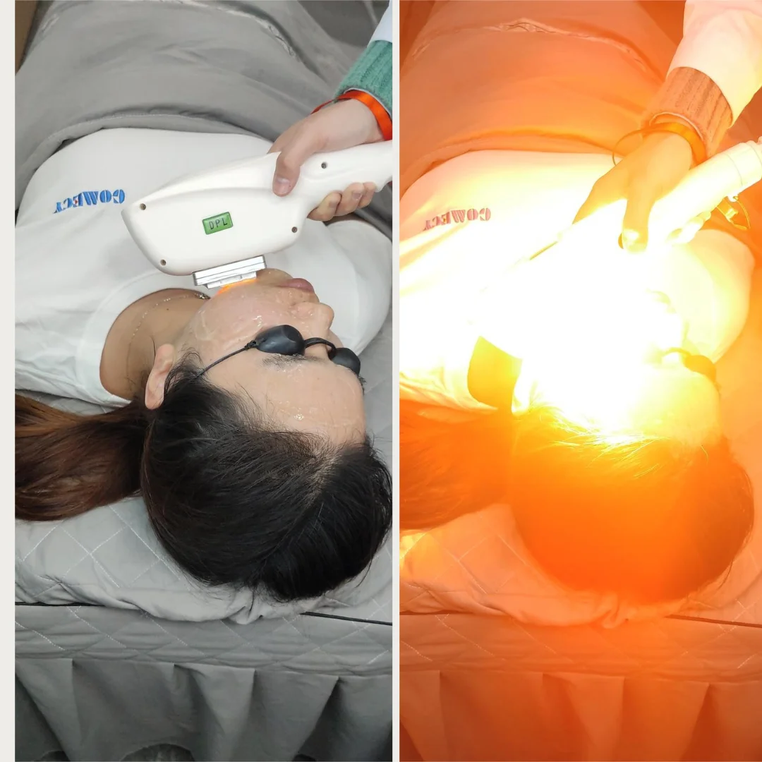 GOMECY-Multifunction-beauty-machine-3-in-1-elight-ipl-opt-rf-nd-yag-ipl-laser-hair-in-Beijing