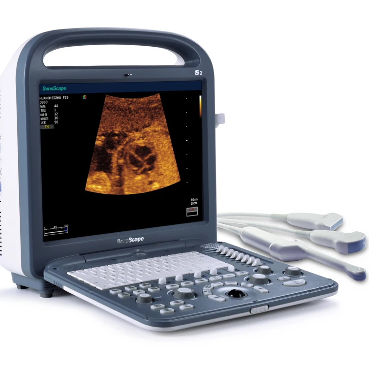 Sonoscape Medical Ultrasound Instruments 3D 4D 15 Inch High Definition LCD Screen Color Doppler Ultrasound Machine