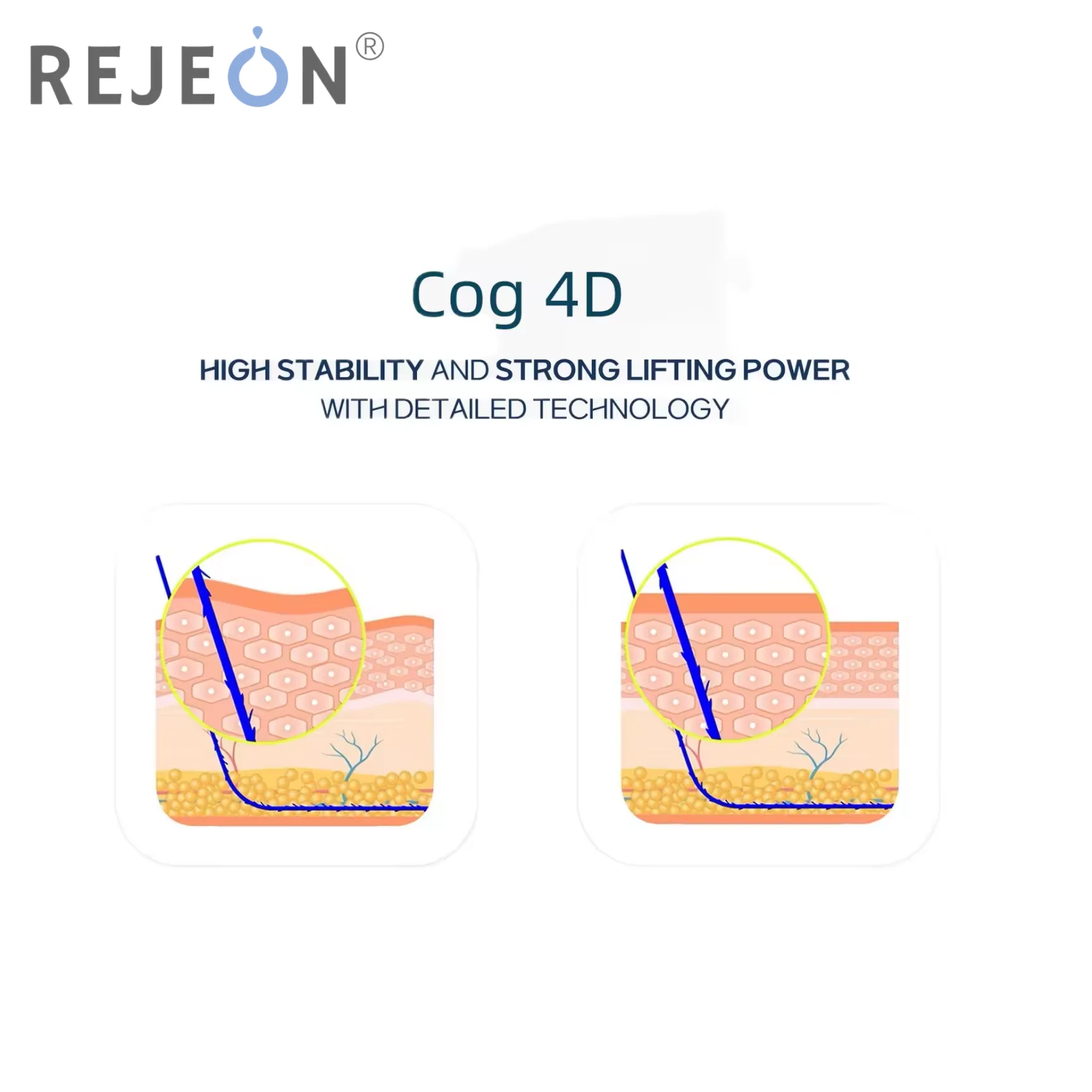 Beauty Ultra V Lift 18g 100mm Blunt W Thread Fios De Wires Lift Barbed Threads Cog 4d Pdo Lift