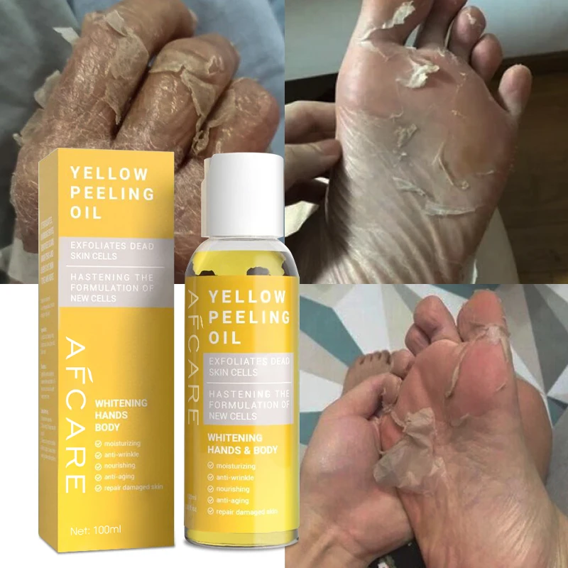 Extra Whitening Yellow Peeling Oil Skin Revitalizer Firming and Organic Lactic Acid Peeling Oil for Dark Knuckles in Ghana