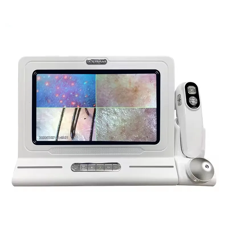 Portable Salon Hair Analyzer/ Hair Scalp Scanner/ Hair Analysis Machine