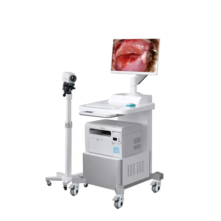 RUIHUA factory price RH-220F electronic colposcope instrument HD 1080P model