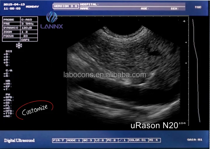 LANNX URason N20 Well Designed Black and White Portable Ultrasound Scanner Ecografia Portatil Laptop Digital USG Diagnostic