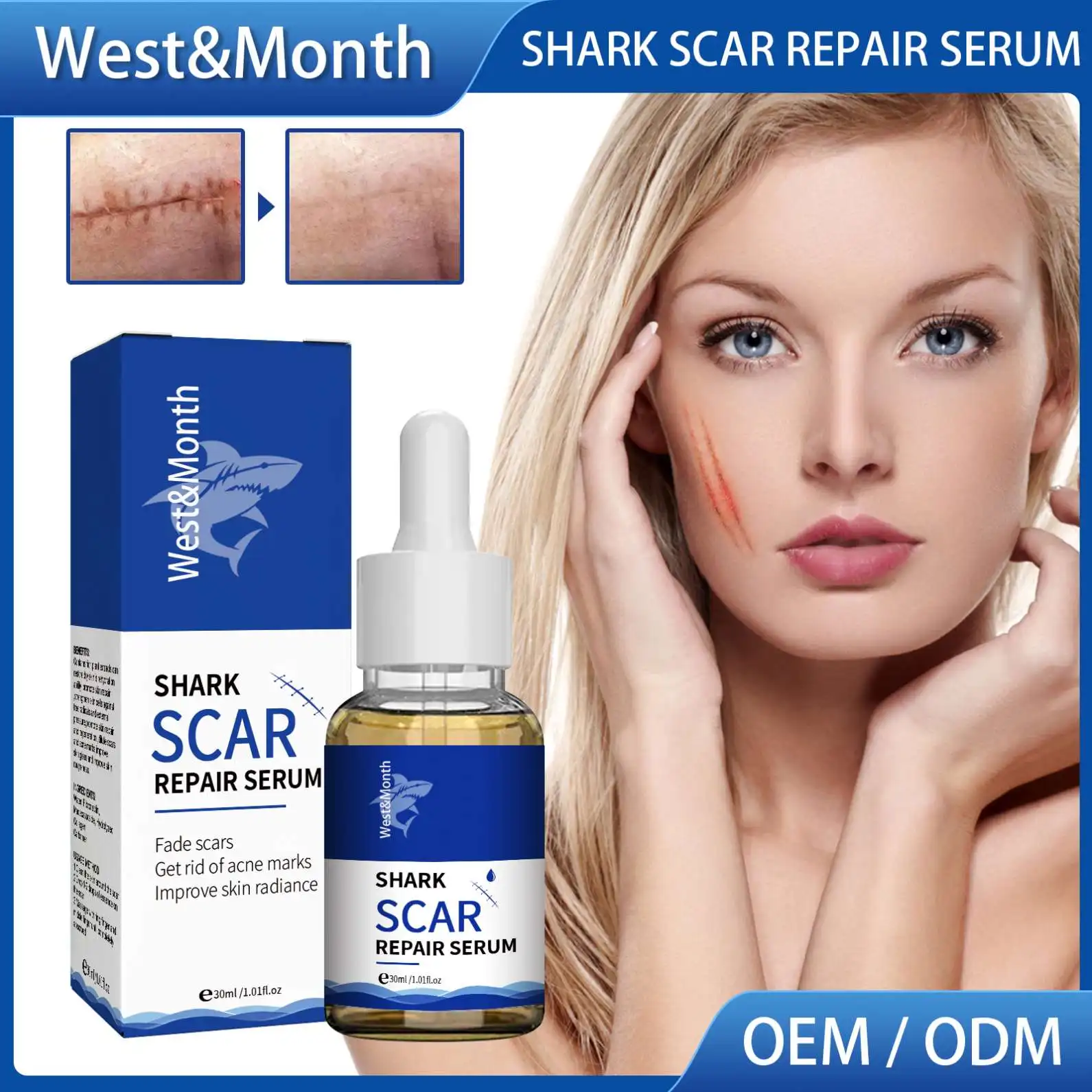 West Moon Wholesale Skin Care Scar Acne Mark Pimples Spots Repair Serum Shark Scar Treatment Oil Scar Removal Gel
