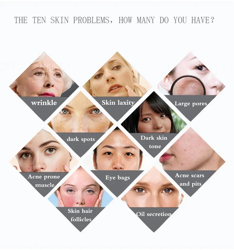 Hair follicles scalp scanner hair analysis functional equipment beauty equipment wholesalers