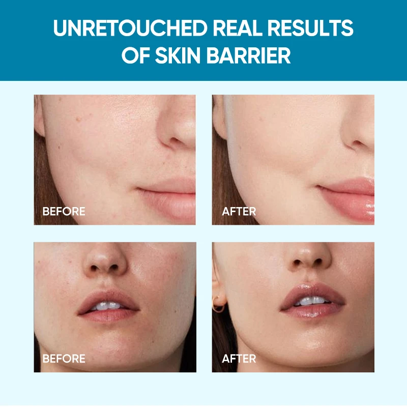 Wholesale 5x Ceramide Barrier Repair Moisture Gel With Hyaluronic Acid Centella Marine-Collage Face Cream