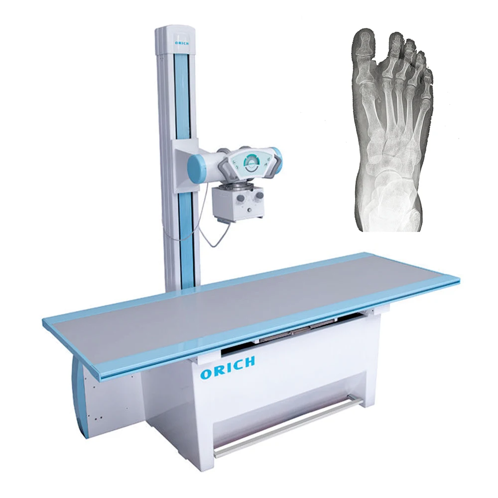 50kw 80kw High frequency digital radiography x ray machine price for medical radiology equipment x-ray inspection machine