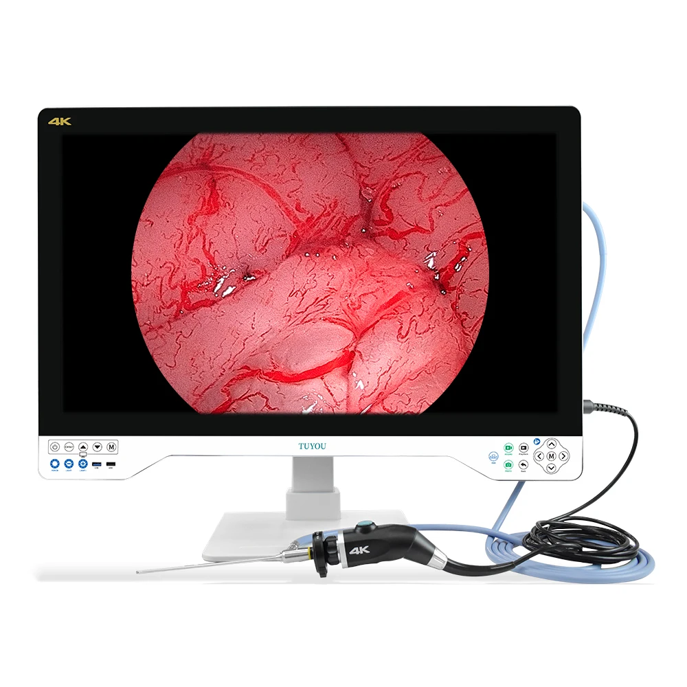 Tuyou 32'  Portable Rigid Medical Video Endoscopy Camera System come with LED Light Source for Laparoscopy Arthroscopy Urology