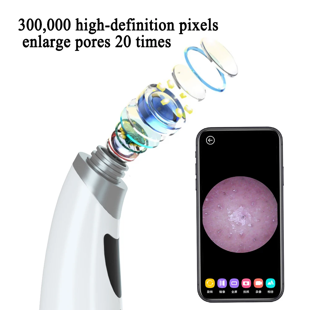 2021 New Fashion Style Visible Dermabrasion Acne Comedon Extractor Creme Blackhead Remover 5 Adjustable Suction Force
