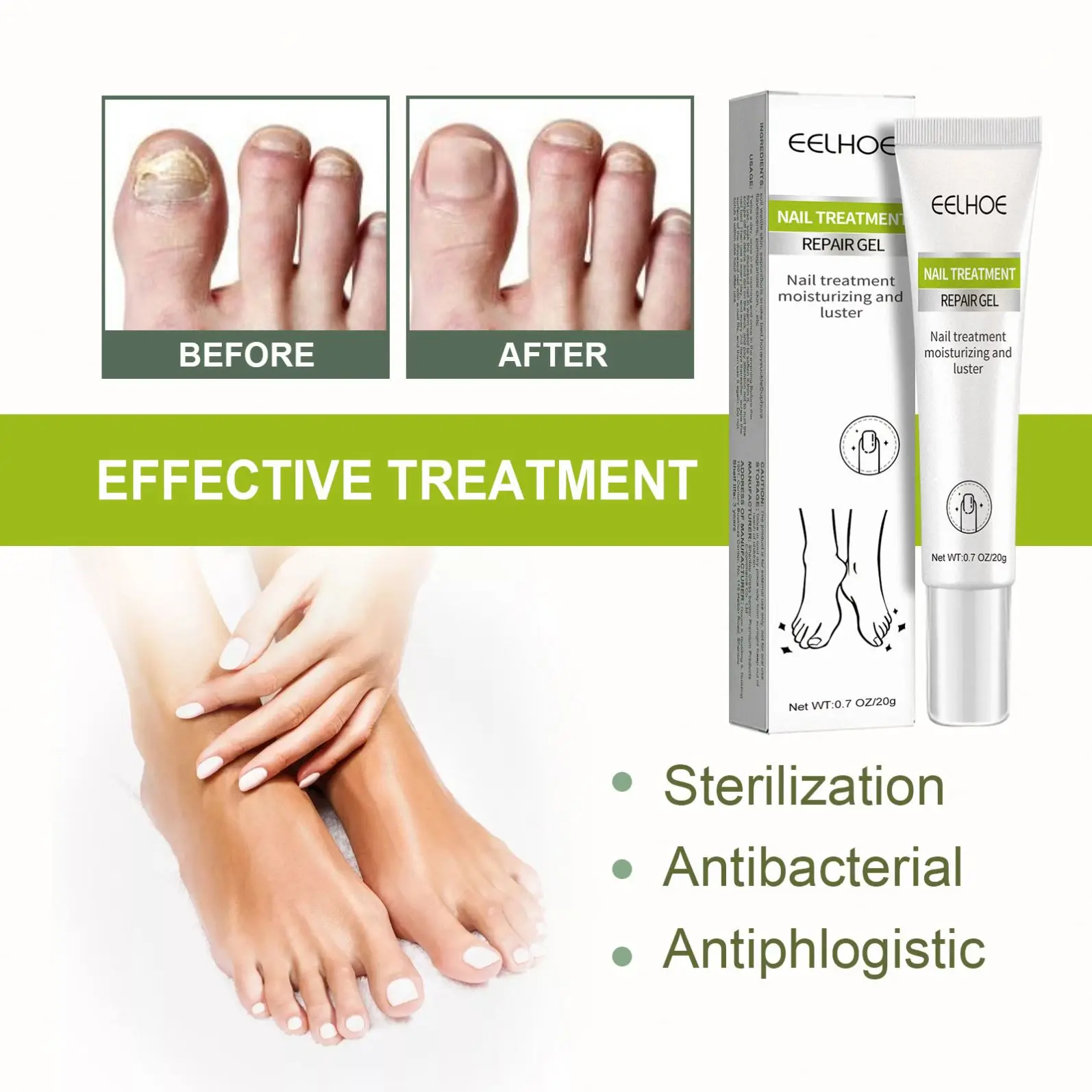 Costom Natural Organic Nail Care Paronychia Fungal Treatment Nourishing Soft Nail Repair Bad Thickening Fungal Treatment Gel 20g