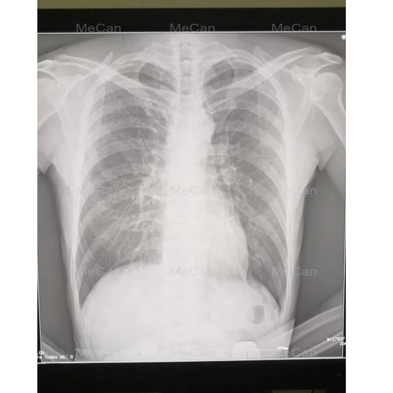  Переносной рентгеновский аппарат Digital X Ray Machine Храктеристика устройства: