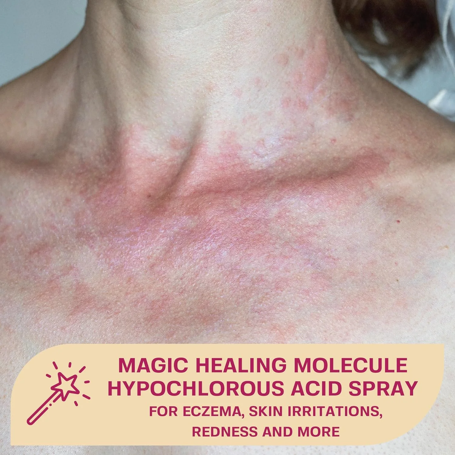 ETRUN ALISA private label Soothing and calming Mist hypochlorous acid face spray toner for eczema skin irritations redness