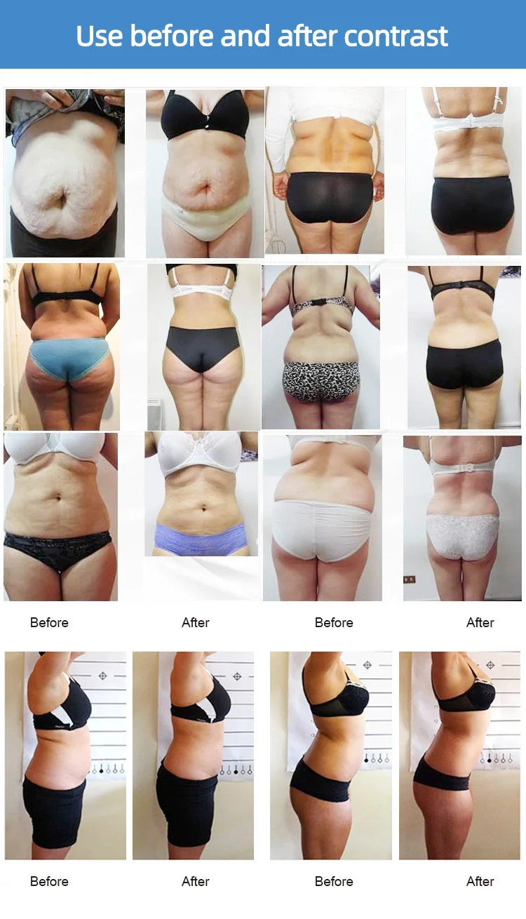 Dual wave laserlipo (10)