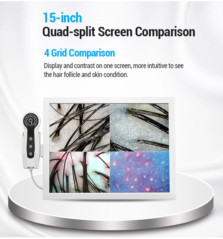 Wholesale price 15 Inch Digital HD Screen Home Use Skin And Scalp Hair Analyzer