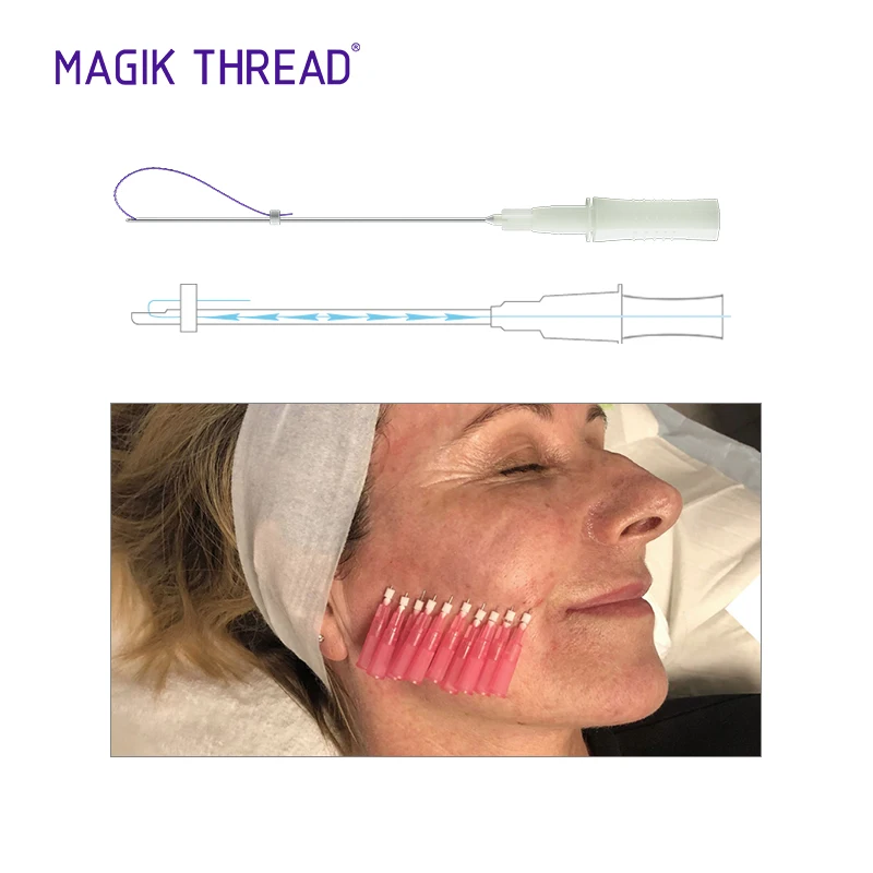 CE certificate Mono Blunt 30G 25MM lifting thread face lift 4d for eye bags