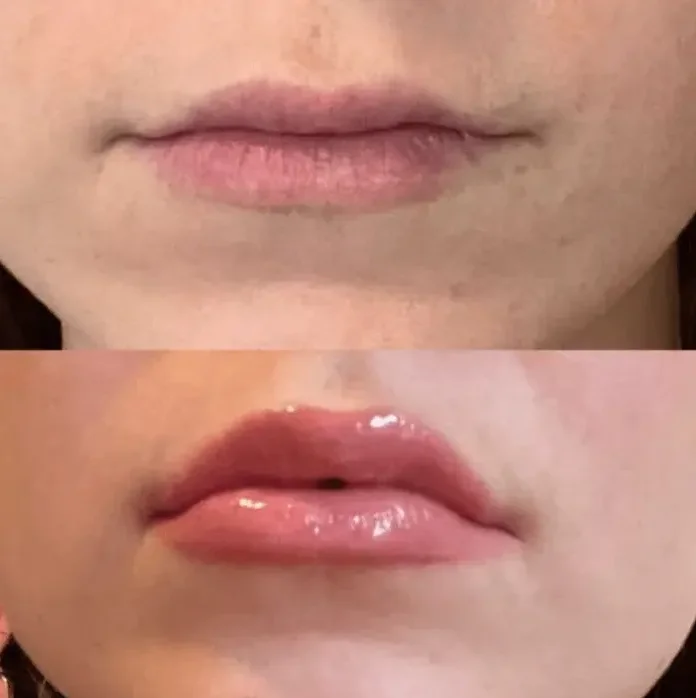 Popular Ultimate Volume Peppermint Oil Long-term Vegan Lip Filler Pen Private Label