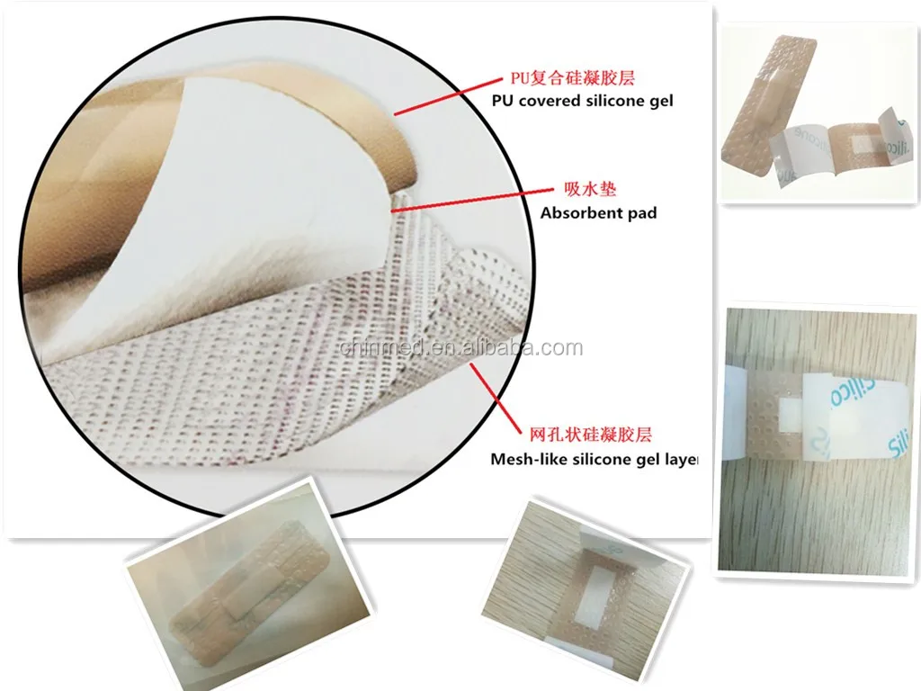 OEM Various Sizes Silicone Foam Dressing Wound Dressing Wholesale Silicone Foam Dressing Cure and Nursing Contact Layer