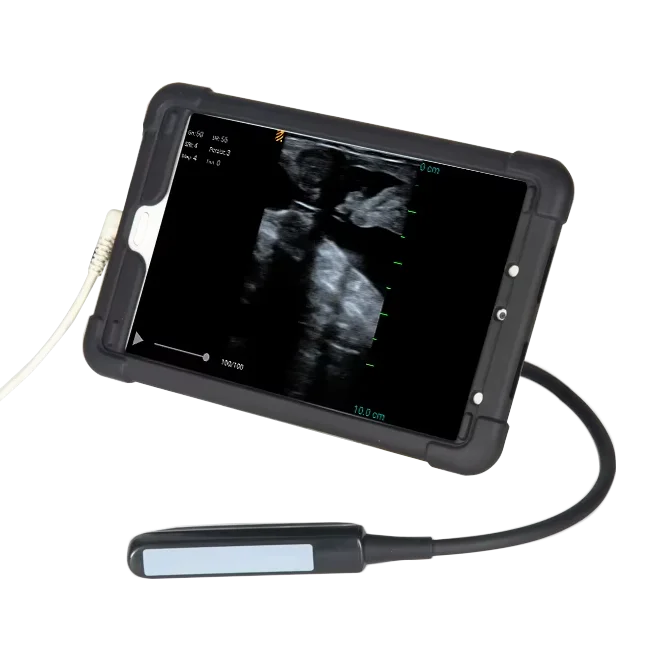Wireless Ultrasound 2023 New Clinical Analytical Instruments Usb Machine Probe Color Doppler