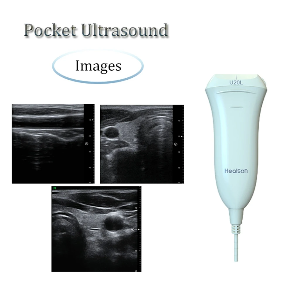 U20L USG Full Digital Mini Ultrasound Price Portable Ultrasound Machine Medical Instruments With Smartphone