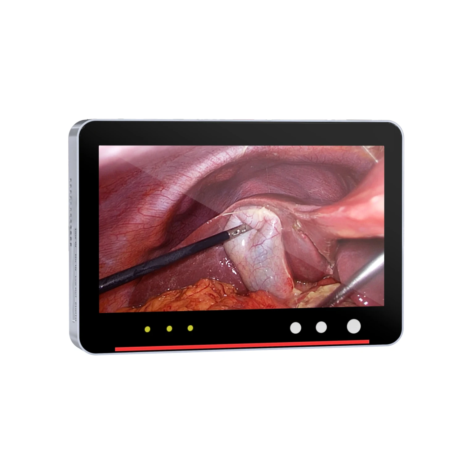 Unisheen High Class Medical Portable Endoscope Surgical Full HD Video Recorder For ENT Gynecology and Laparoscopic Camera System