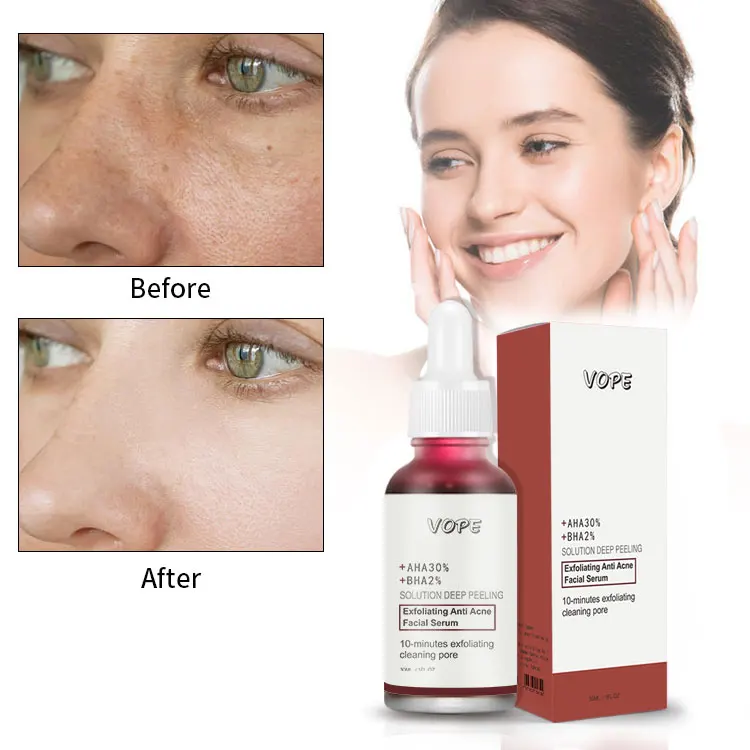 Private label skin care aha 30% bha 2% peeling solution whitening brightening hyaluronic acid face serum