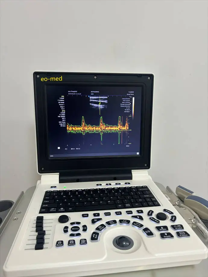 Medical Supplies High Quality Fully Digital Portable Ultrasound Scanner Ultrasound Scanning Machine BW20