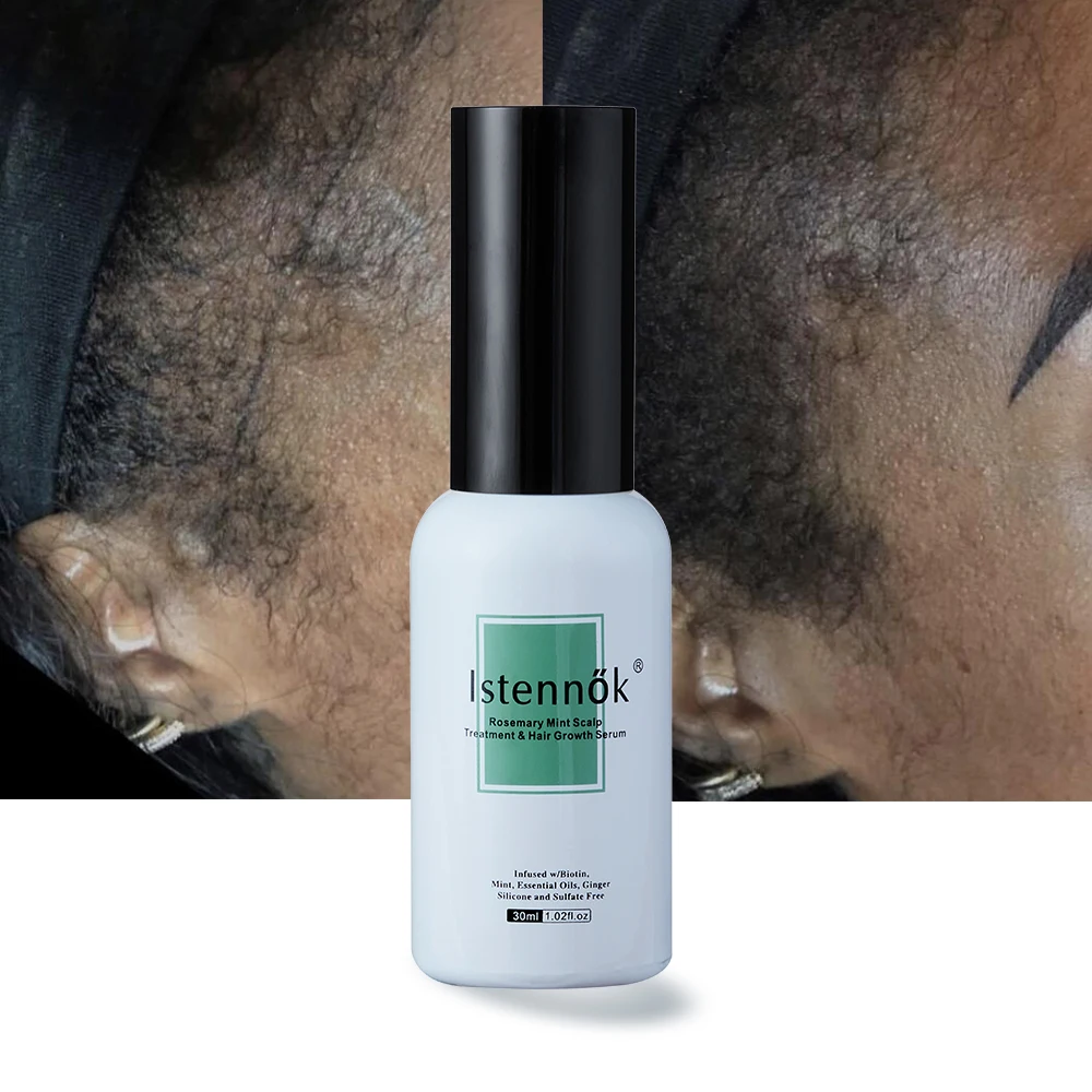 Keratin Protein Hair Treatment Serum Hair Loss Prevention Thinning Hair Thickening Tonic